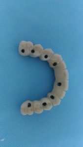 Protocolo ceramico (3)