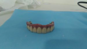 Protocolo ceramico (4)